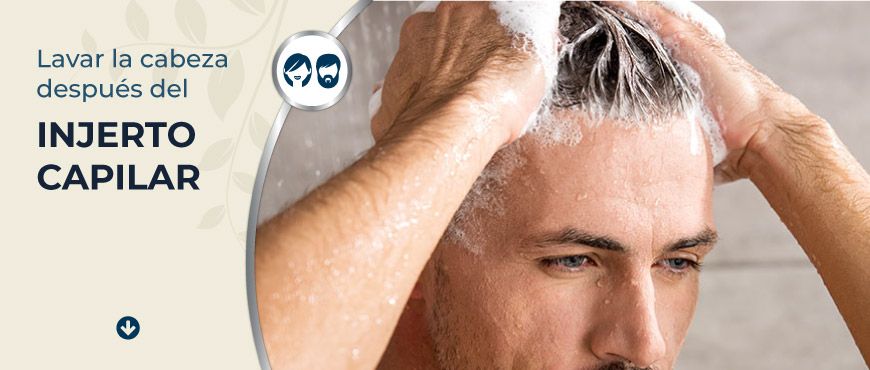 ¿Cuándo lavarse el pelo después de mesoterapia capilar?